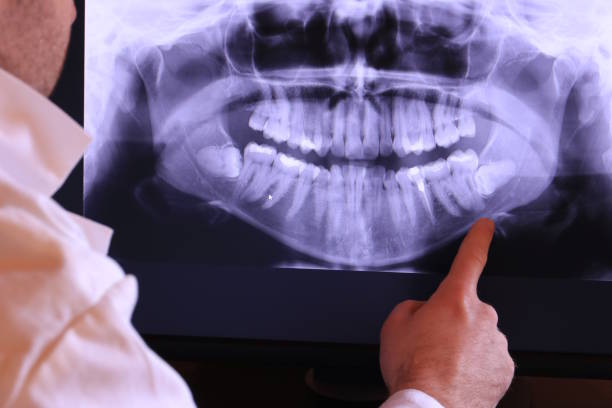 Best Emergency Broken Tooth Repair in Fulton, MO